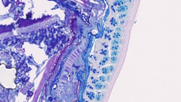 Leaky Gut