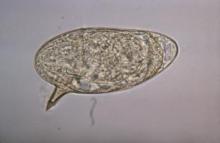 Schistosoma mansoni egg