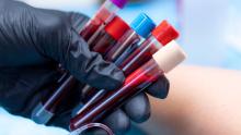 blood shutterstock