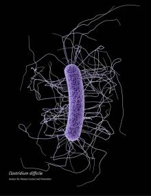 Clostridioides difficile - CDC